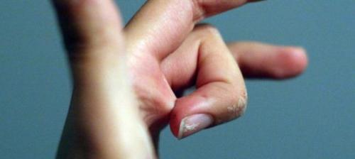 Чем растворить суперклей: каждому материалу — свои полезные советы