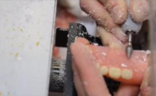 Ремонт зубных протезов в домашних условиях. Срочный ремонт зубных протезов 06 Ремонт зубных протезов в домашних условиях. Срочный ремонт зубных протезов 06