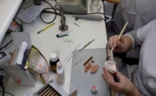 Ремонт зубных протезов в домашних условиях. Срочный ремонт зубных протезов 05 Ремонт зубных протезов в домашних условиях. Срочный ремонт зубных протезов 05