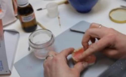 Ремонт зубных протезов в домашних условиях. Срочный ремонт зубных протезов 08 Ремонт зубных протезов в домашних условиях. Срочный ремонт зубных протезов 08